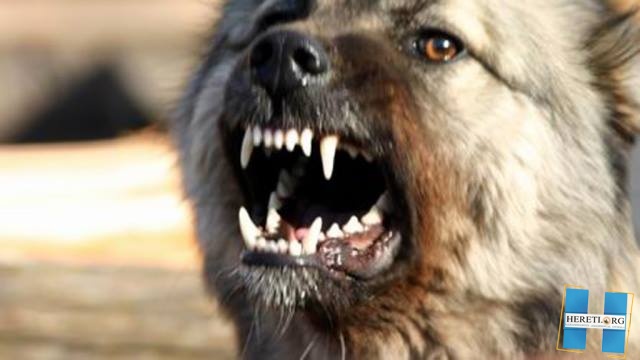 Собака покусала 10 летнего ребёнка